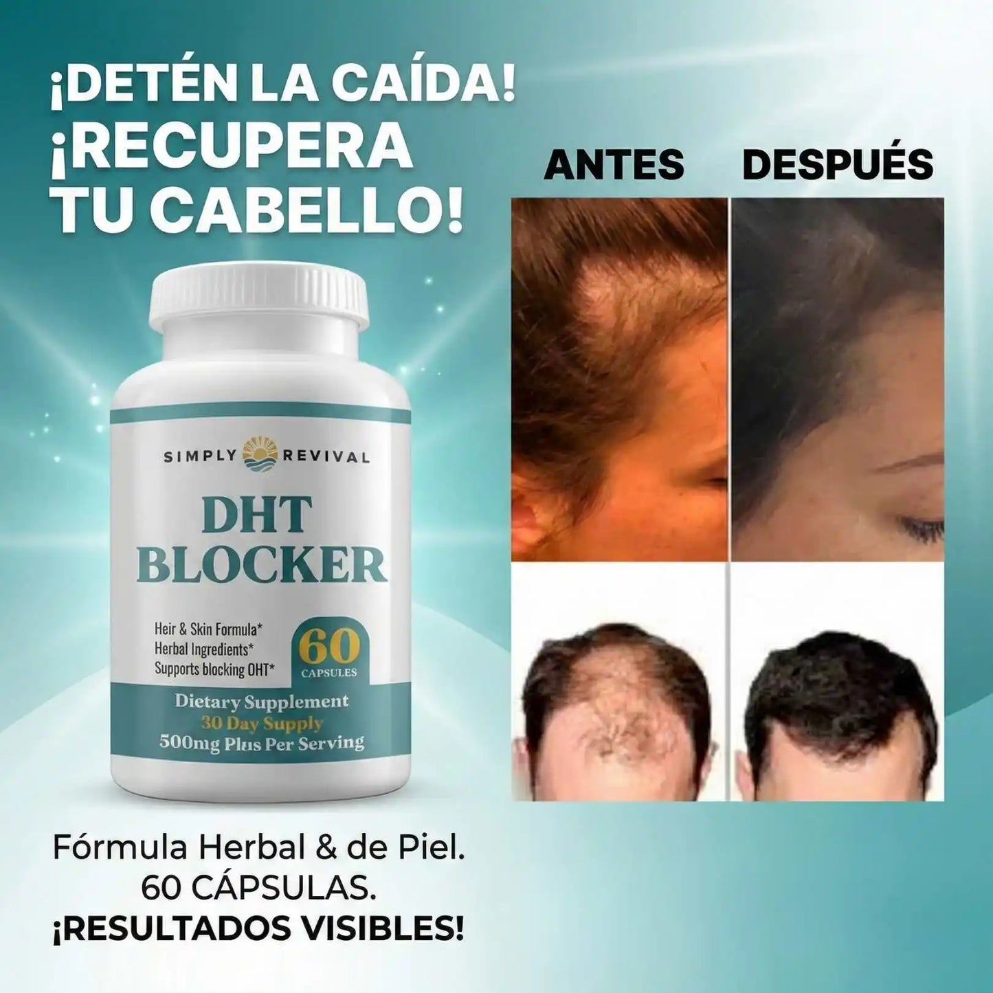 DHT BLOCKER (Recuperación Capilar)