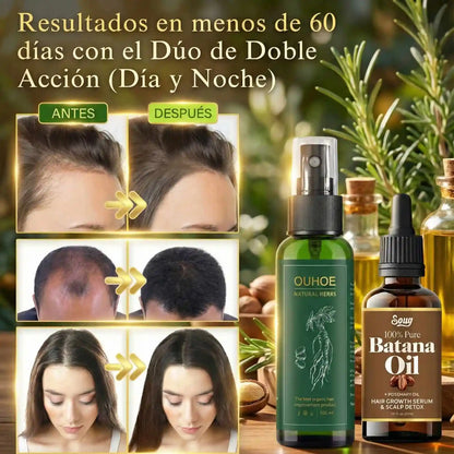 KIT TÓNICO OUHOE + ACEITE DE BATANA (Crecimiento Intensivo)