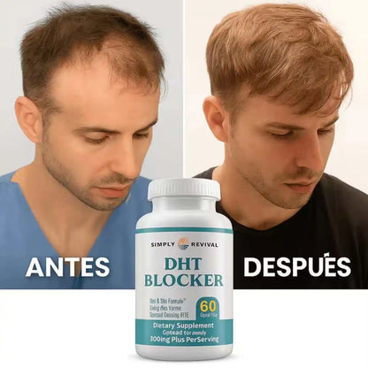 DHT BLOCKER (Recuperación Capilar)